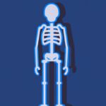 soñar con huesos de personas