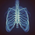 Qué es una tele de tórax