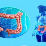 Qué es la coloproctología