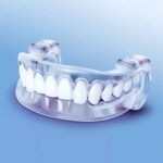 Qué es guarda oclusal